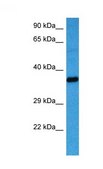 Anti-AKR1B1 antibody produced in rabbit IgG fraction of antiserum