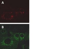 LentiBrite RFP-p62 Lentiviral Biosensor