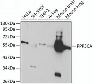 Anti-PPP3CA antibody produced in rabbit