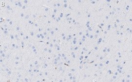 Anti-Tau-1 Antibody, clone PC1C6 ZooMAb® Mouse Monoclonal recombinant, expressed in HEK 293 cells
