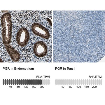 Anti-PGR antibody produced in rabbit Ab2, Prestige Antibodies® Powered by Atlas Antibodies, affinity isolated antibody, buffered aqueous glycerol solution