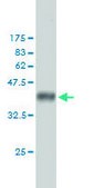 Monoclonal Anti-AR antibody produced in mouse clone 1G3, purified immunoglobulin, buffered aqueous solution