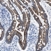Anti-CPS1 antibody produced in rabbit Prestige Antibodies® Powered by Atlas Antibodies, affinity isolated antibody, buffered aqueous glycerol solution