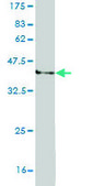 Monoclonal Anti-WRN antibody produced in mouse clone 3C11, purified immunoglobulin, buffered aqueous solution