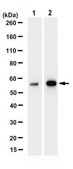 Anti-Nicotinic Acetylchone Receptor alpha 1 Antibody, clone 7C8.2 clone 7C8.2, from mouse