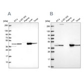Anti-GOT1 antibody produced in rabbit Prestige Antibodies® Powered by Atlas Antibodies, affinity isolated antibody