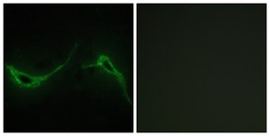 Anti-ADCY7 antibody produced in rabbit affinity isolated antibody