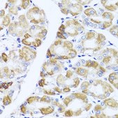 Anti-PIK3CA antibody produced in rabbit