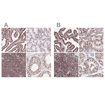 Anti-XRCC6 antibody produced in rabbit Prestige Antibodies® Powered by Atlas Antibodies, affinity isolated antibody, buffered aqueous glycerol solution