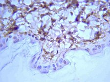 Anti-Rat Collagen Type I Antibody Chemicon®, from rabbit