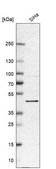 Anti-BRD9 antibody produced in rabbit Prestige Antibodies® Powered by Atlas Antibodies, affinity isolated antibody, buffered aqueous glycerol solution