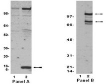 Anti-acetyl-Lysine Antibody, clone 4G12 clone 4G12, Upstate®, from mouse