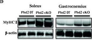 Monoclonal Anti-Myosin (Skeletal, Slow) antibody produced in mouse clone NOQ7.5.4D, ascites fluid