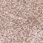 Monoclonal Anti-Msh3 Antibody Produced In Mouse Prestige Antibodies® Powered by Atlas Antibodies, clone CL14059, affinity isolated antibody, buffered aqueous glycerol solution