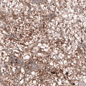 Monoclonal Anti-Adam10 Antibody Produced In Mouse Prestige Antibodies® Powered by Atlas Antibodies, clone CL13809, affinity isolated antibody, buffered aqueous glycerol solution