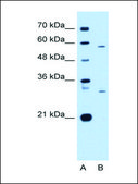 抗 CD36 兔抗 affinity isolated antibody