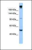 Anti-INSR antibody produced in rabbit affinity isolated antibody
