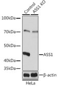 Anti- ASS1 antibody produced in rabbit
