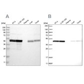 Anti-TUFM antibody produced in rabbit Prestige Antibodies® Powered by Atlas Antibodies, affinity isolated antibody, buffered aqueous glycerol solution