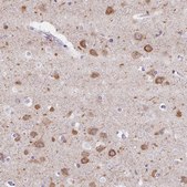 Anti-MAP1A antibody produced in rabbit Prestige Antibodies® Powered by Atlas Antibodies, affinity isolated antibody, buffered aqueous glycerol solution