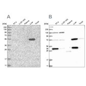 Anti-UGP2 antibody produced in rabbit Prestige Antibodies® Powered by Atlas Antibodies, affinity isolated antibody, buffered aqueous glycerol solution