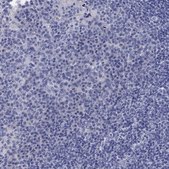 Anti-CETN1 antibody produced in rabbit Prestige Antibodies® Powered by Atlas Antibodies, affinity isolated antibody, buffered aqueous glycerol solution