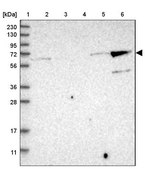 Anti-KLHL26 antibody produced in rabbit Prestige Antibodies® Powered by Atlas Antibodies, affinity isolated antibody, buffered aqueous glycerol solution
