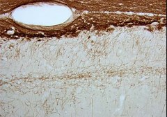 Anti-Myelin Associated Glycoprotein Antibody, clone 513 clone 513, Chemicon®, from mouse