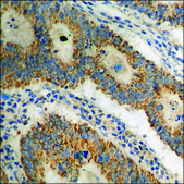 Anti-phospho-DARPP-32 (pThr34) antibody produced in rabbit affinity isolated antibody
