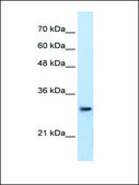 Anti-PSMA1 antibody produced in rabbit affinity isolated antibody