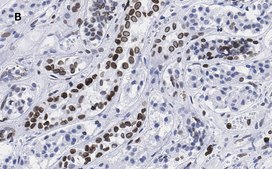 Anti-Lamin B1 Antibody, clone 6K22, ZooMAb® Rabbit Monoclonal recombinant, expressed in HEK 293 cells