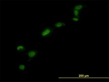 Monoclonal Anti-HMGB1 antibody produced in mouse clone 1D5, purified immunoglobulin, buffered aqueous solution