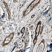 Anti-MCAM antibody produced in rabbit Prestige Antibodies® Powered by Atlas Antibodies, affinity isolated antibody, buffered aqueous glycerol solution