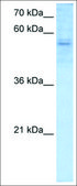 Anti-RBPJ antibody produced in rabbit affinity isolated antibody