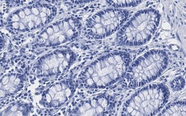 Anti-Mn-SOD Antibody, clone 1C14 ZooMAb® Rabbit Monoclonal recombinant, expressed in HEK 293 cells