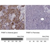 Anti-PNMT antibody produced in rabbit Prestige Antibodies® Powered by Atlas Antibodies, affinity isolated antibody, buffered aqueous glycerol solution
