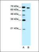 Anti-RORA (AB3) antibody produced in rabbit IgG fraction of antiserum