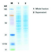 cOmplete™ Lysis-M Individually packed in foil blister packs