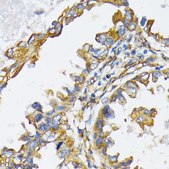 Anti-HSP90B1 antibody produced in rabbit