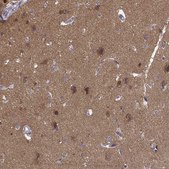 Anti-PRKCE antibody produced in rabbit Prestige Antibodies® Powered by Atlas Antibodies, affinity isolated antibody, buffered aqueous glycerol solution