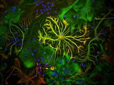 抗胶质纤维酸性蛋白抗体 Chemicon®, from chicken