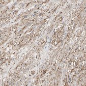 Anti-ANXA6 antibody produced in rabbit Prestige Antibodies® Powered by Atlas Antibodies, affinity isolated antibody, buffered aqueous glycerol solution