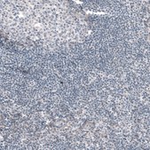 Monoclonal Anti--G6PC antibody produced in mouse Prestige Antibodies® Powered by Atlas Antibodies, clone CL5817, purified immunoglobulin, buffered aqueous glycerol solution