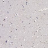 Anti-LYN antibody produced in rabbit Prestige Antibodies® Powered by Atlas Antibodies, affinity isolated antibody, buffered aqueous glycerol solution
