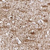 Anti-CNP antibody produced in rabbit Prestige Antibodies® Powered by Atlas Antibodies, affinity isolated antibody, buffered aqueous glycerol solution, Ab3