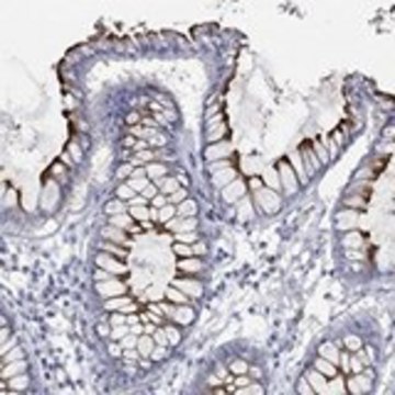 Anti-KCNA1 antibody produced in rabbit Prestige Antibodies® Powered by Atlas Antibodies, affinity isolated antibody, buffered aqueous glycerol solution