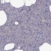 Anti-CDK5 antibody produced in rabbit Prestige Antibodies® Powered by Atlas Antibodies, affinity isolated antibody