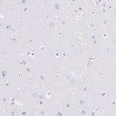 Anti-FGB antibody produced in rabbit Ab2, Prestige Antibodies® Powered by Atlas Antibodies, affinity isolated antibody, buffered aqueous glycerol solution