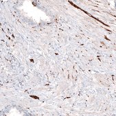 Monoclonal Anti-TUBB3 antibody produced in mouse Prestige Antibodies® Powered by Atlas Antibodies, clone CL5814, purified immunoglobulin, buffered aqueous glycerol solution
