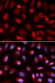 Anti-NF-kB p65 antibody produced in rabbit